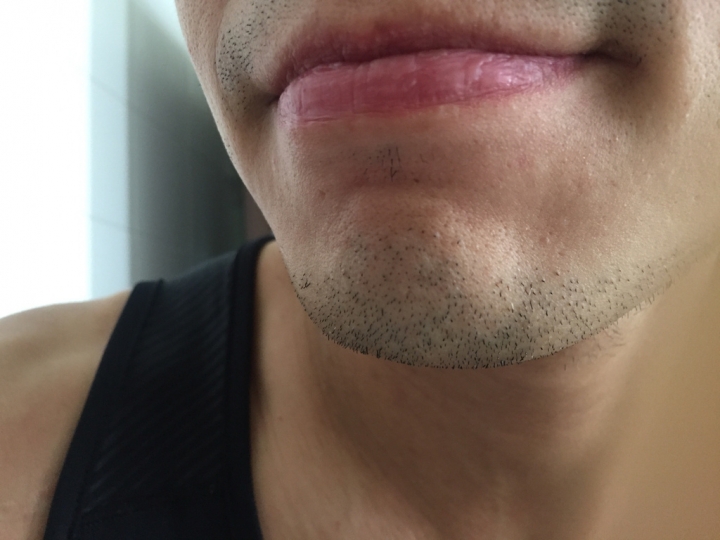 【開箱實測】抗痘14天親身實驗報告 男研堂 HODR MEN\