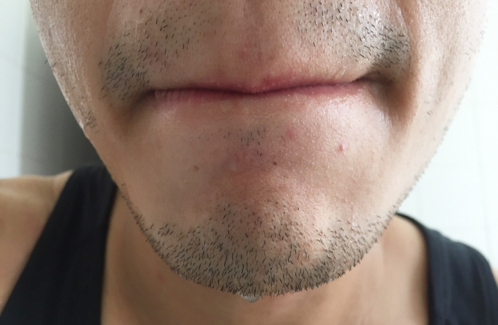 【開箱實測】抗痘14天親身實驗報告 男研堂 HODR MEN\