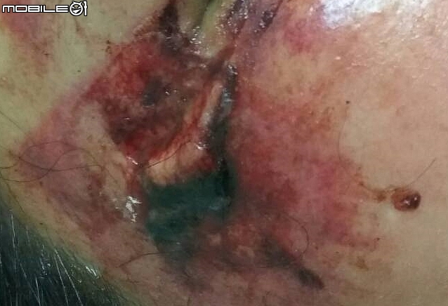 車禍 未拍到燈號之路口影片，如何正確讀秒，還我清白！? (有受傷照片、膽小者勿入！)