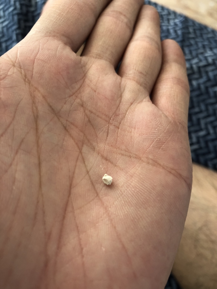 請問！ 這是不是石綿