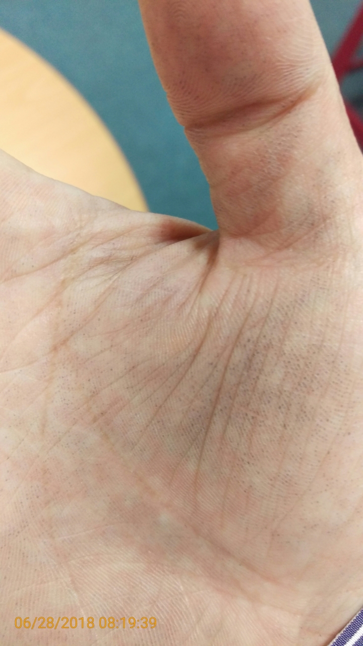 請問各位戴皮手套是否有此問題?