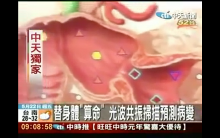 黑心騙錢健檢5DMRA 可惡!!!