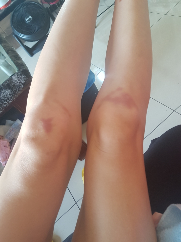 繼上次怪病，讓我發現主因