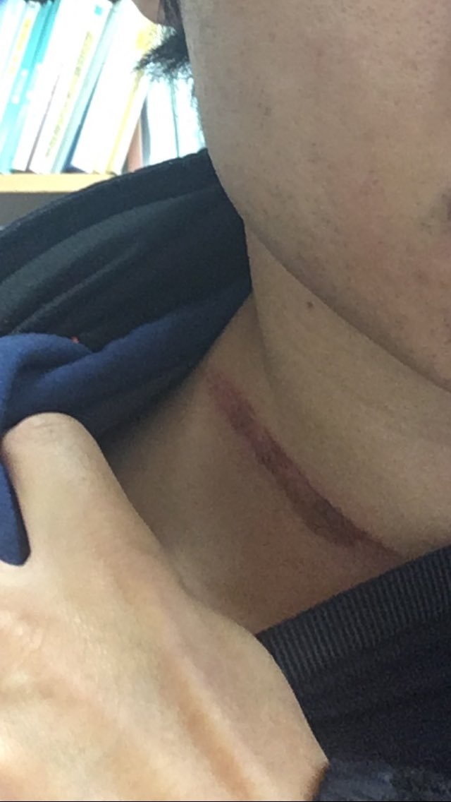 安全氣囊突然爆了