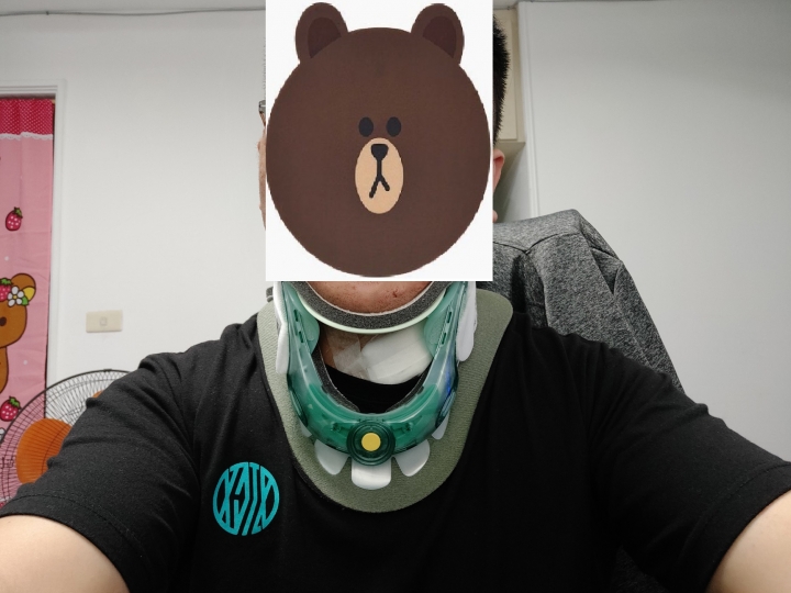 頸椎盤突出 心得+心情+治療過程 療程結束,結束更新