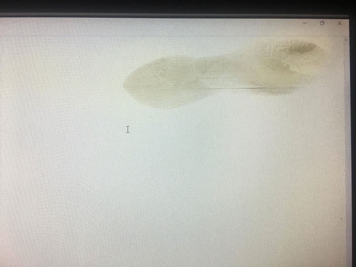 螢幕變這樣還有救嗎