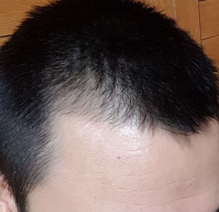 只是個人的養髮心得