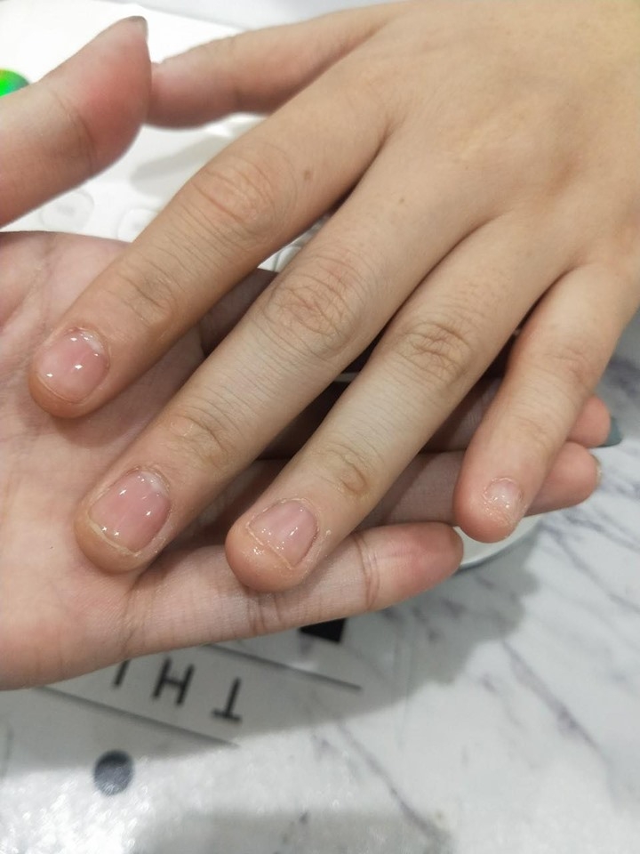 指甲矯正期，真的需要很忍耐？ (分享調整指甲期間的感想和照片 )