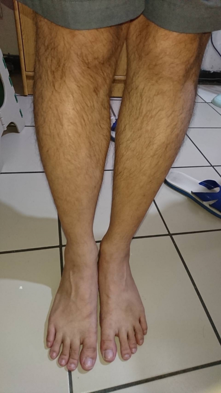 40歲中年壯漢的小腿跟腳丫(有圖)