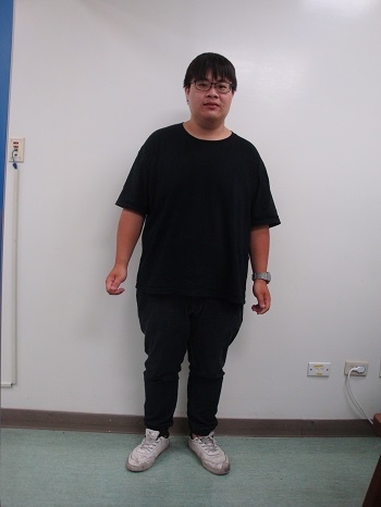 分享我的夾胃手術心得