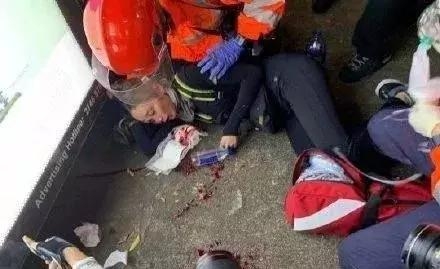 爆眼女收黎智英500萬封口費後“被消失” 演員冒充出鏡不慎穿幫！黎智英大怒：讓她永遠消失！已無利用價值！