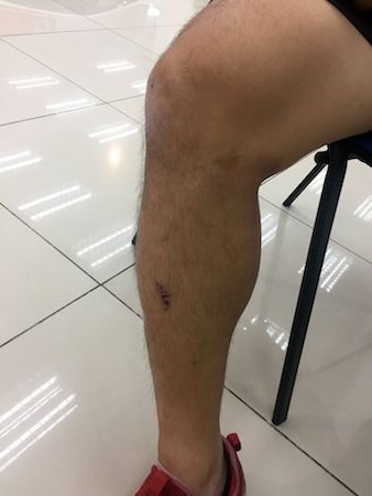 撞成這樣人還沒事