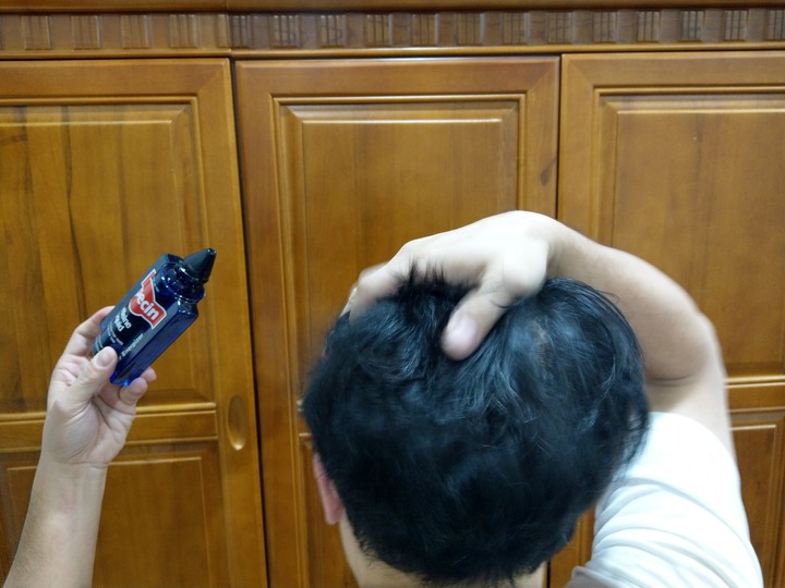 德國髮現工程Alpecin咖啡因頭髮液 試用心得