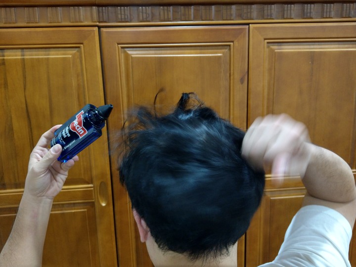 德國髮現工程Alpecin咖啡因頭髮液 試用心得
