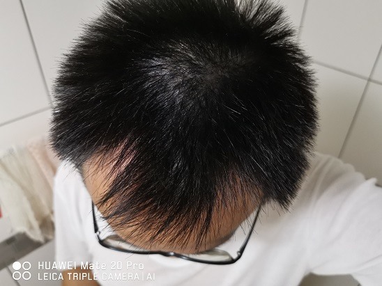 【♥ 男性限定 推薦 ♥】《德國髮現工程Alpecin咖啡因頭髮液》Alpecin咖啡因頭髮液 (Alpecin Liquid) 試用活動