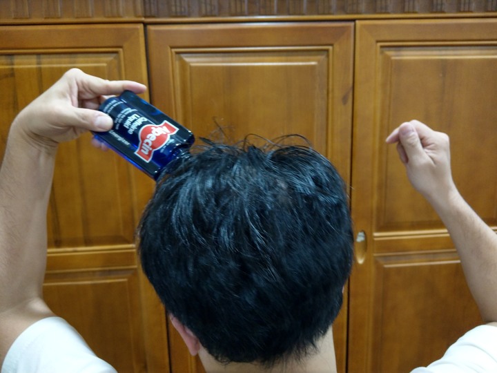 德國髮現工程Alpecin咖啡因頭髮液 試用心得