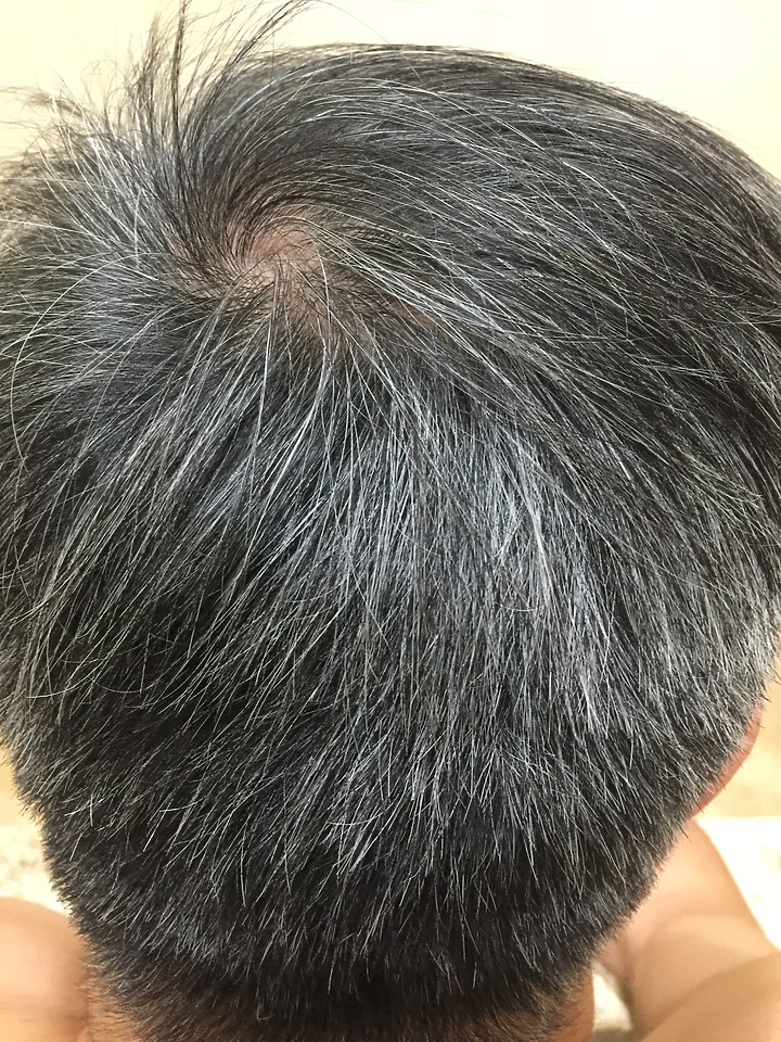 點我看大圖 給頭髮的正能量,用《Alpecin咖啡因洗髮露》告別女人香,讓頭髮變年輕了 !!!