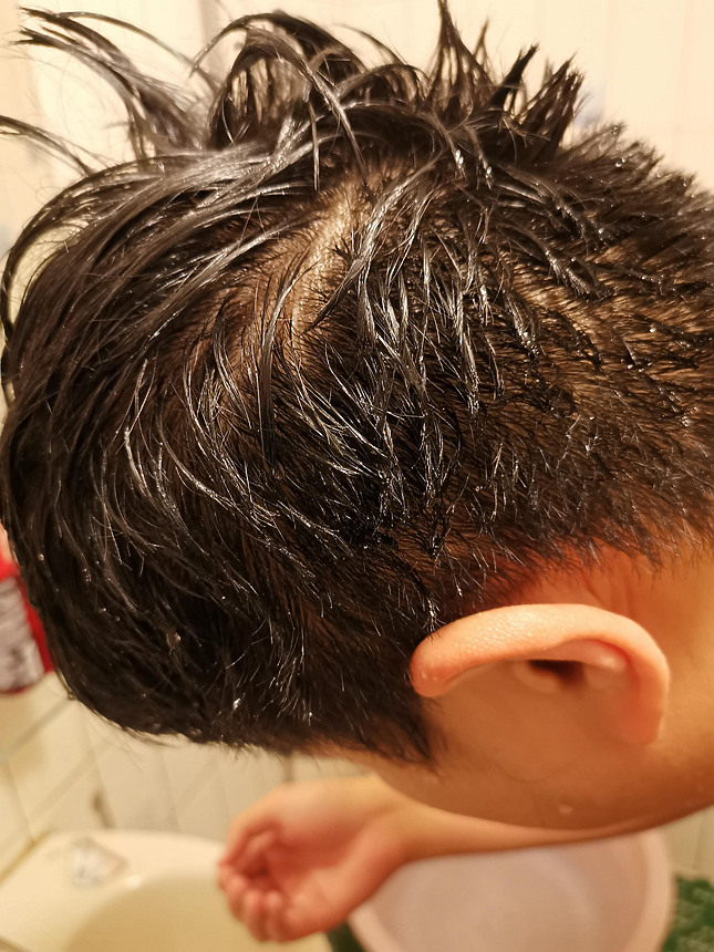 (擺脫頭皮屑及健髮問題)德國髮現工程男用洗髮露Alpecin Double Effect使用推薦心得分享