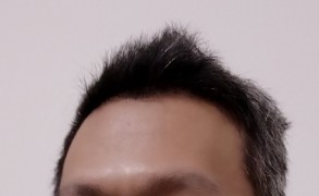 【體驗】德國髮現工程Alpecin Double Effect雙效咖啡因抗頭皮屑洗髮露