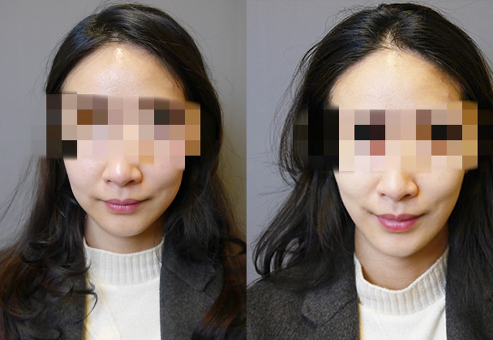 當個最美的新娘