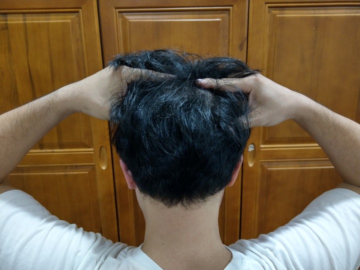 德國髮現工程Alpecin咖啡因頭髮液 試用心得
