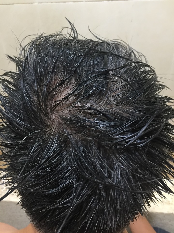點我看大圖 給頭髮的正能量,用《Alpecin咖啡因洗髮露》告別女人香,讓頭髮變年輕了 !!!