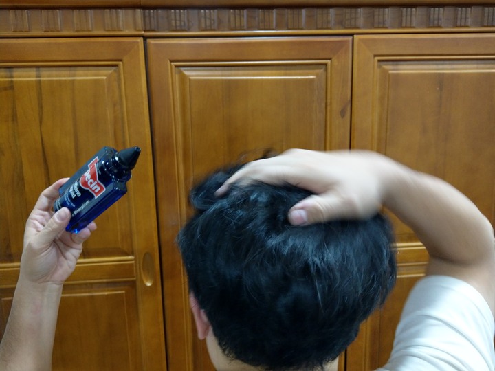 德國髮現工程Alpecin咖啡因頭髮液 試用心得