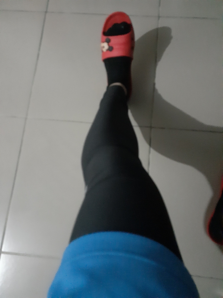 腿怎麼變成這樣啊？？