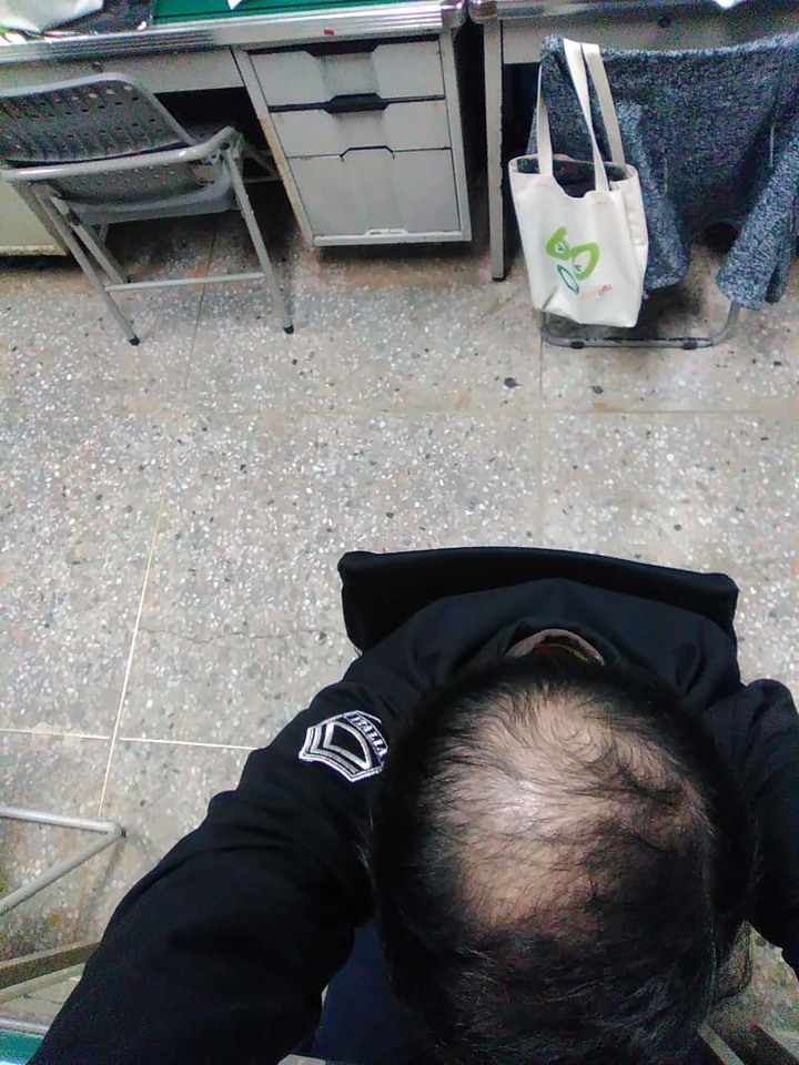 抗禿有感之iRestore生髮帽使用心得與效果分享(四個月，附照片)