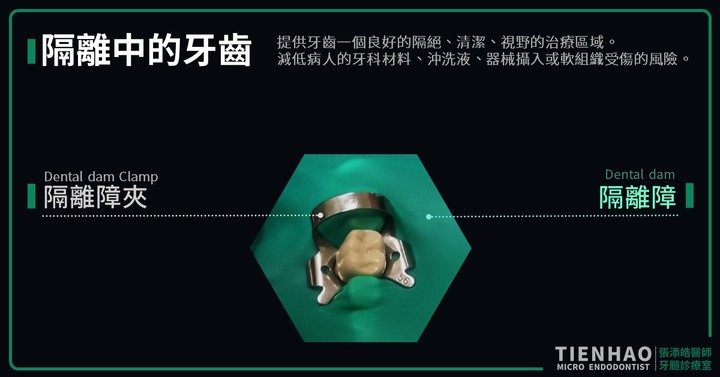 牙齒陶瓷嵌體分享,抱怨?(醫生請進)