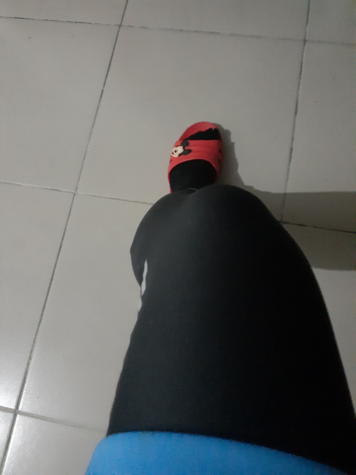 腿怎麼變成這樣啊？？