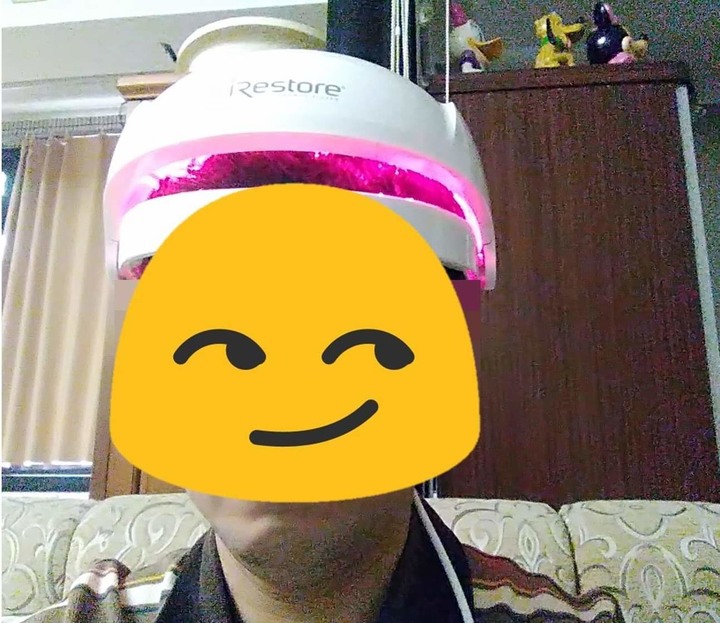 抗禿有感之iRestore生髮帽使用心得與效果分享(四個月，附照片)