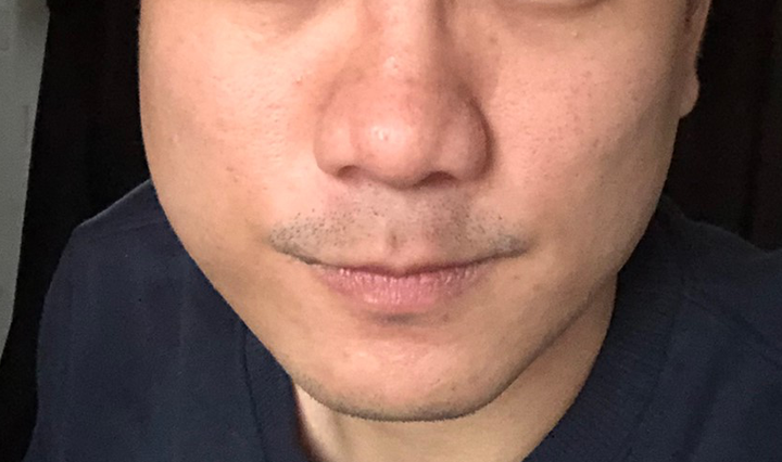 粉刺痘痘肌推薦的臉部保養/洗髮/刮鬍產品