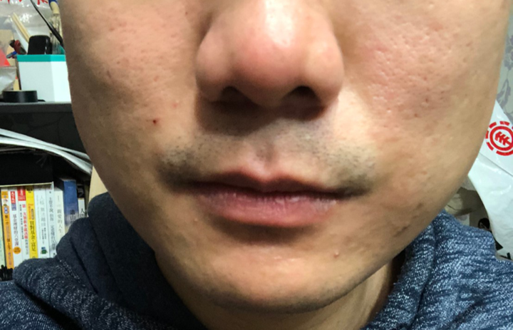 粉刺痘痘肌推薦的臉部保養/洗髮/刮鬍產品