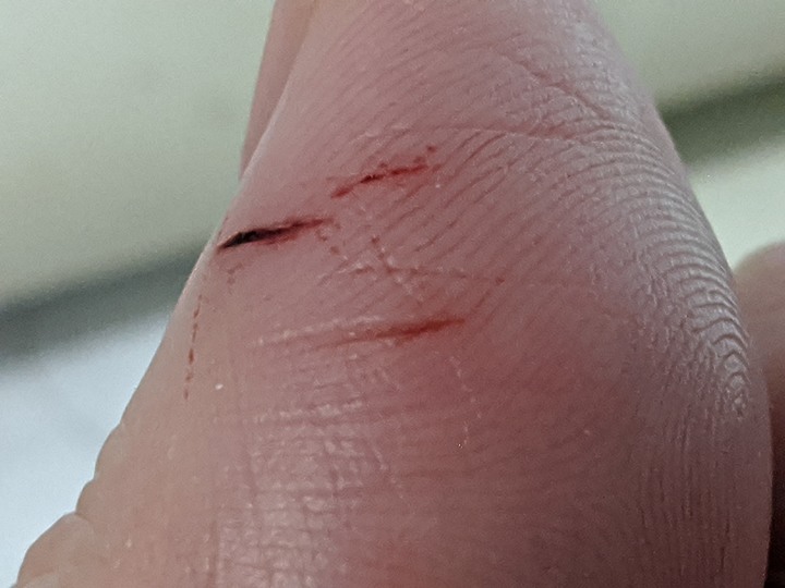 手指被槳葉打到，馬上就...