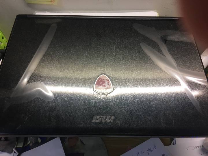 大家gs d蓋都長腫瘤嗎？ （gs要注意這問題喔）