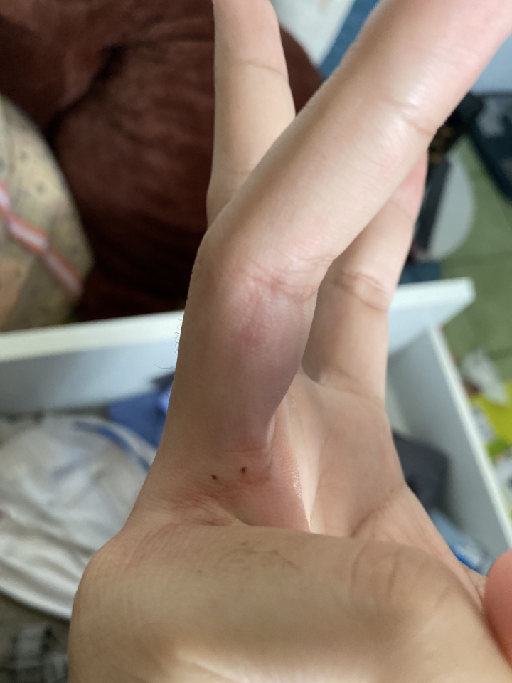這是怎麼了？？？
