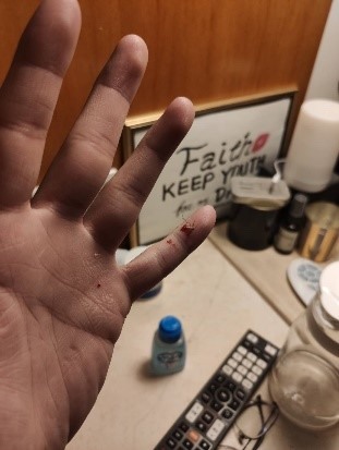 夏天蚊蟲叮咬強效止癢藥分享-護那酷涼液