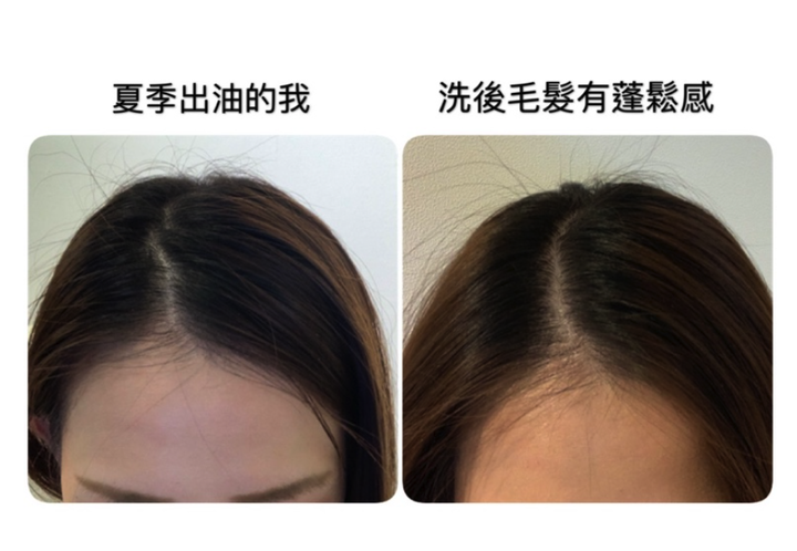 夏季頭髮容易出油，跪求各位漂亮女孩們可以跟我分享一下好用的洗髮精！！