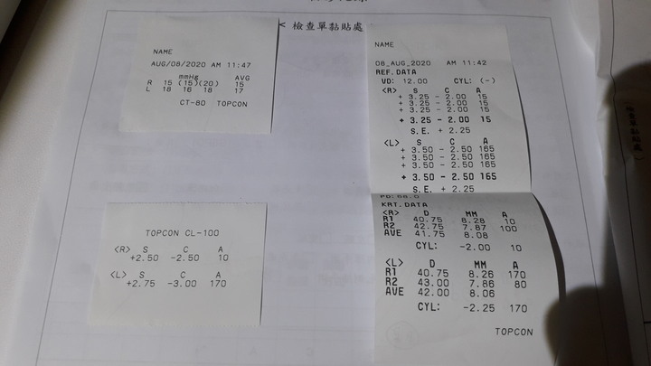 眼睛檢查