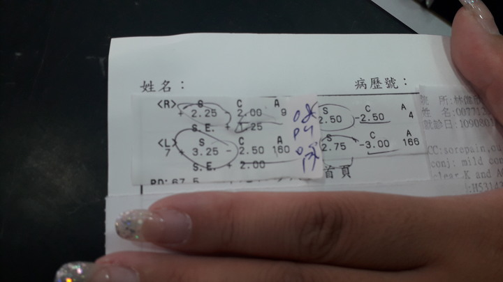 眼睛檢查