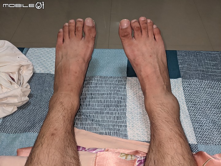 腳踝扭傷