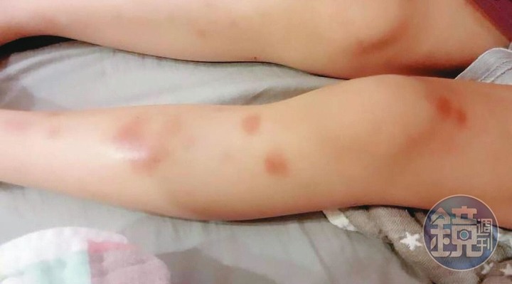 【貴族幼兒園虐童】逼吃嘔吐物北市知名幼兒園爆離譜虐童