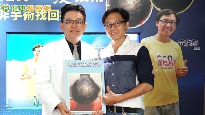 頻掉髮險禿頭名導演嫌拍照顯老急救髪!