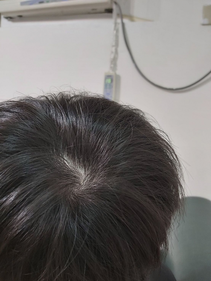 這樣看起來很稀疏嗎？