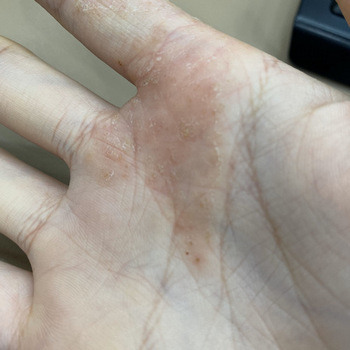 是不是有些人不適合吃中藥