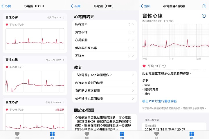 Apple Watch的心電圖ECG功能動手玩 隨手用30秒關心你的小心臟