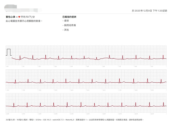 Apple Watch的心電圖ECG功能動手玩 隨手用30秒關心你的小心臟