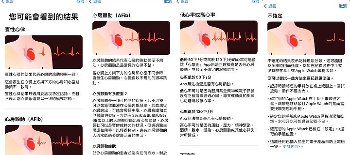 Apple Watch的心電圖ECG功能動手玩 隨手用30秒關心你的小心臟