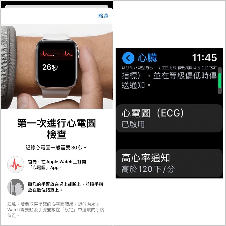 Apple Watch的心電圖ECG功能動手玩 隨手用30秒關心你的小心臟